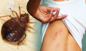 Read more about the article Bed Bug Eradication